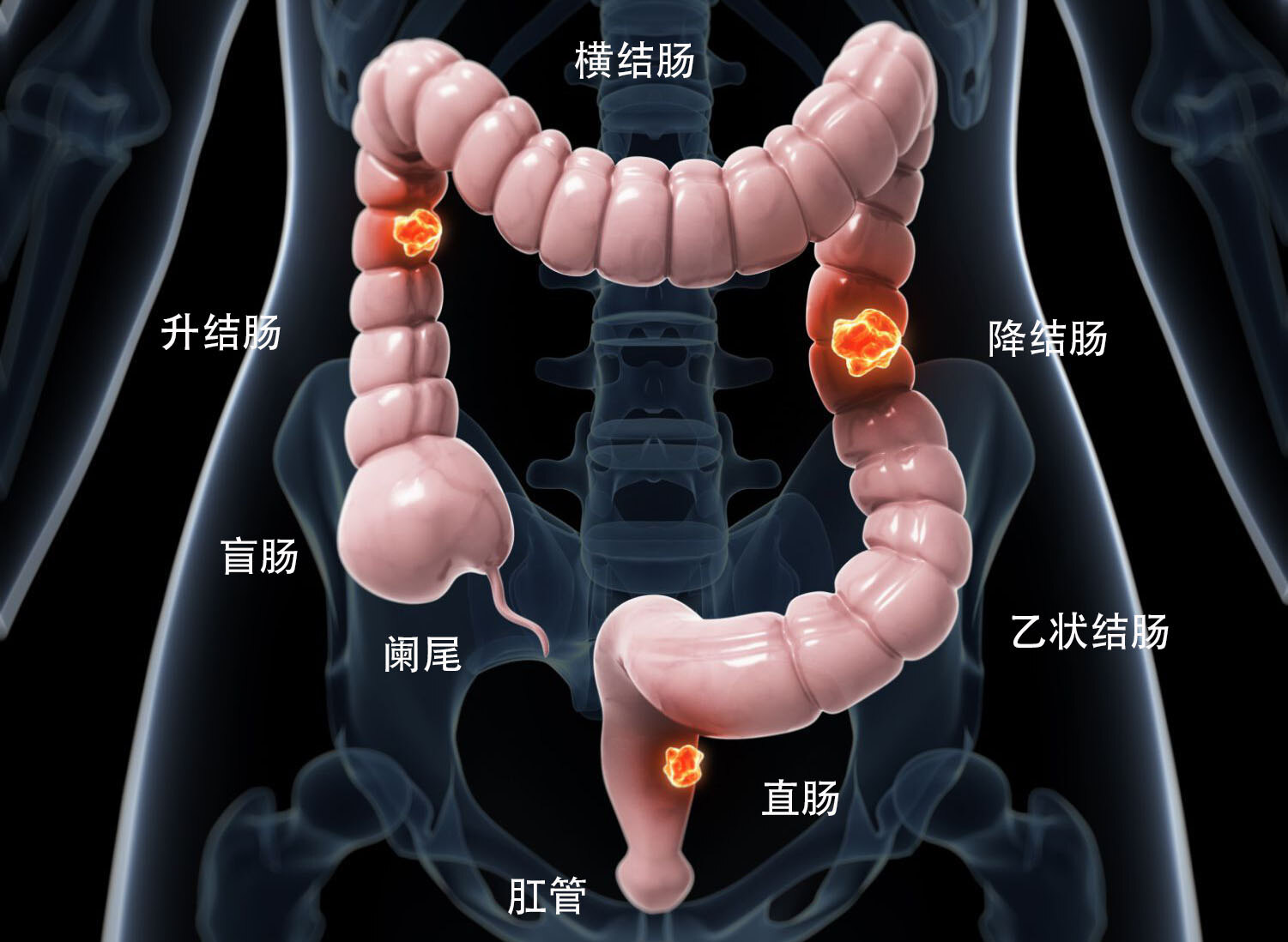 人体的大肠包括:盲肠,阑尾,升结肠,横结肠,降结肠,乙状结肠和直肠.