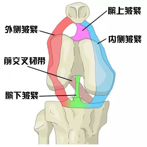 滑膜皱襞综合征一种常见膝关节疼痛原因