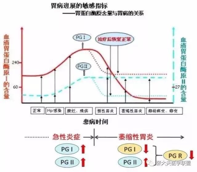 胃蛋白酶原pg的意义
