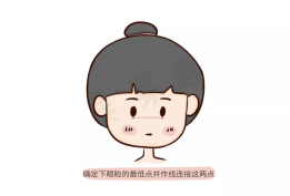 大小脸,偏颌畸形的基本特征有哪些