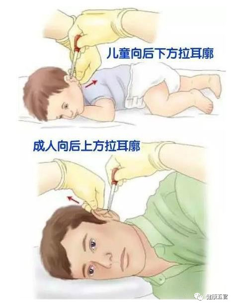 结膜囊是眼睛哪个部位图