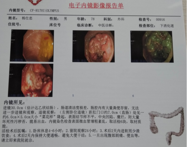 肛指检查的重要性_直肠癌 - 好大夫在线