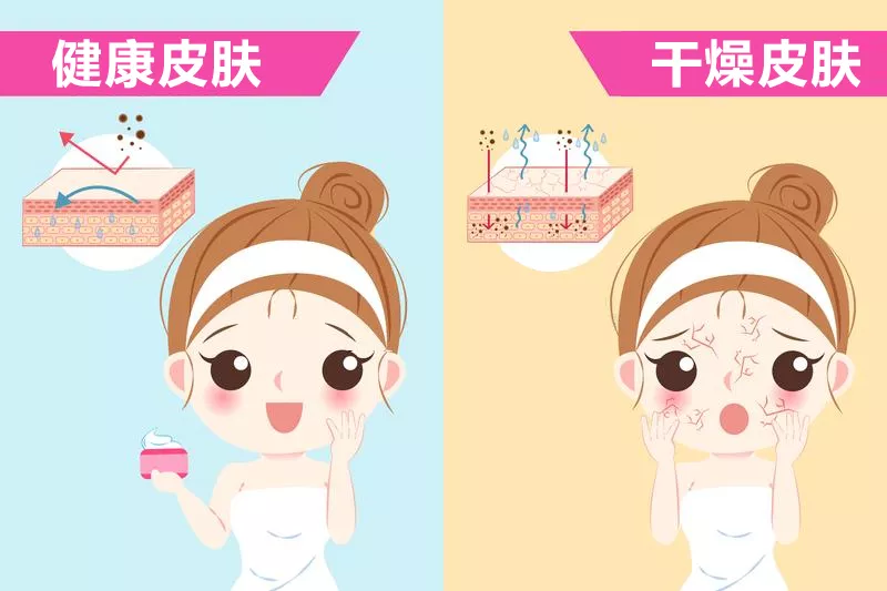 脸干怎么办,皮肤干燥如何应对?_皮肤瘙痒