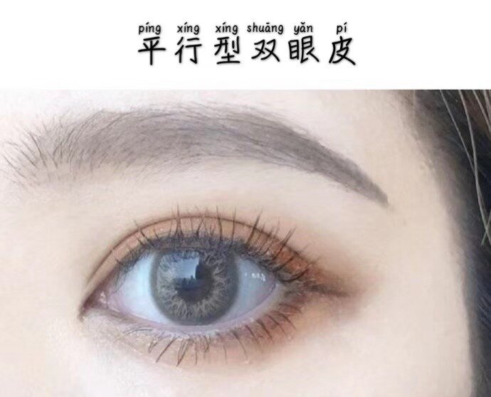 双眼皮有几种款式?