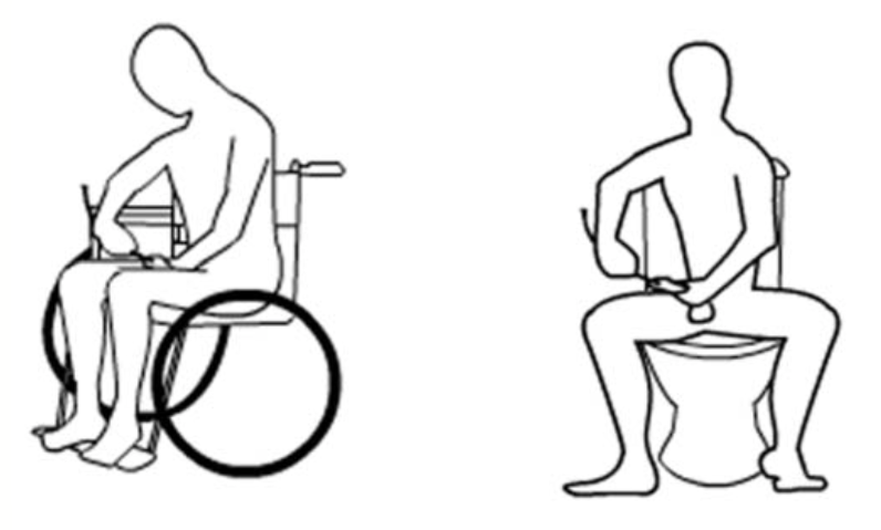 男性间歇导尿 - 好大夫在线