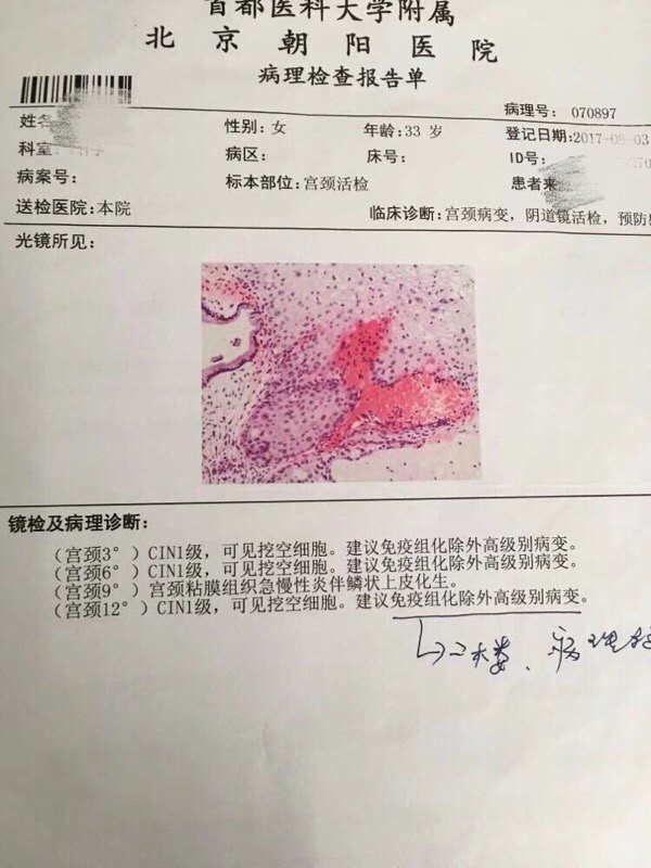 宫颈病变cin1高危型hpv感染治愈病例分享