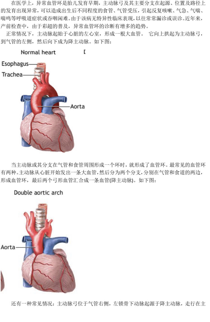 产前检查胎儿心脏彩超发现有异常血管环,这样的宝宝可以生下来吗?