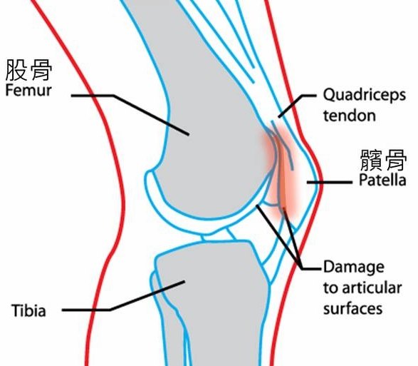 髌骨高清图
