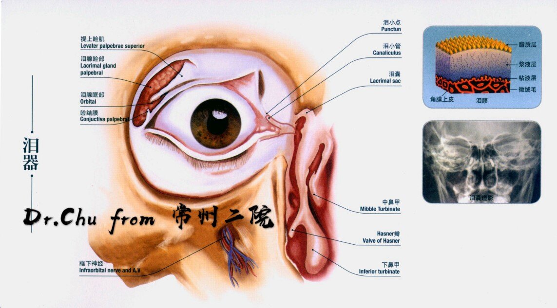 如果您的眼睛经常流泪流脓您需要注意了可能是得了慢性泪囊炎如果是