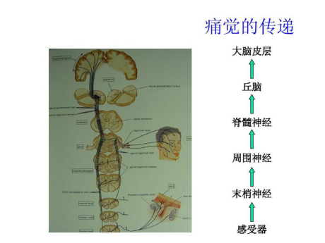 被"两根电极"缓解 脊髓电刺激疗法是一种通过弱电刺激脊髓神经的方法