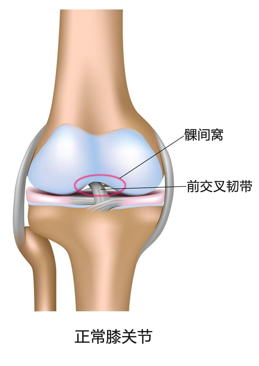 膝关节髁间窝