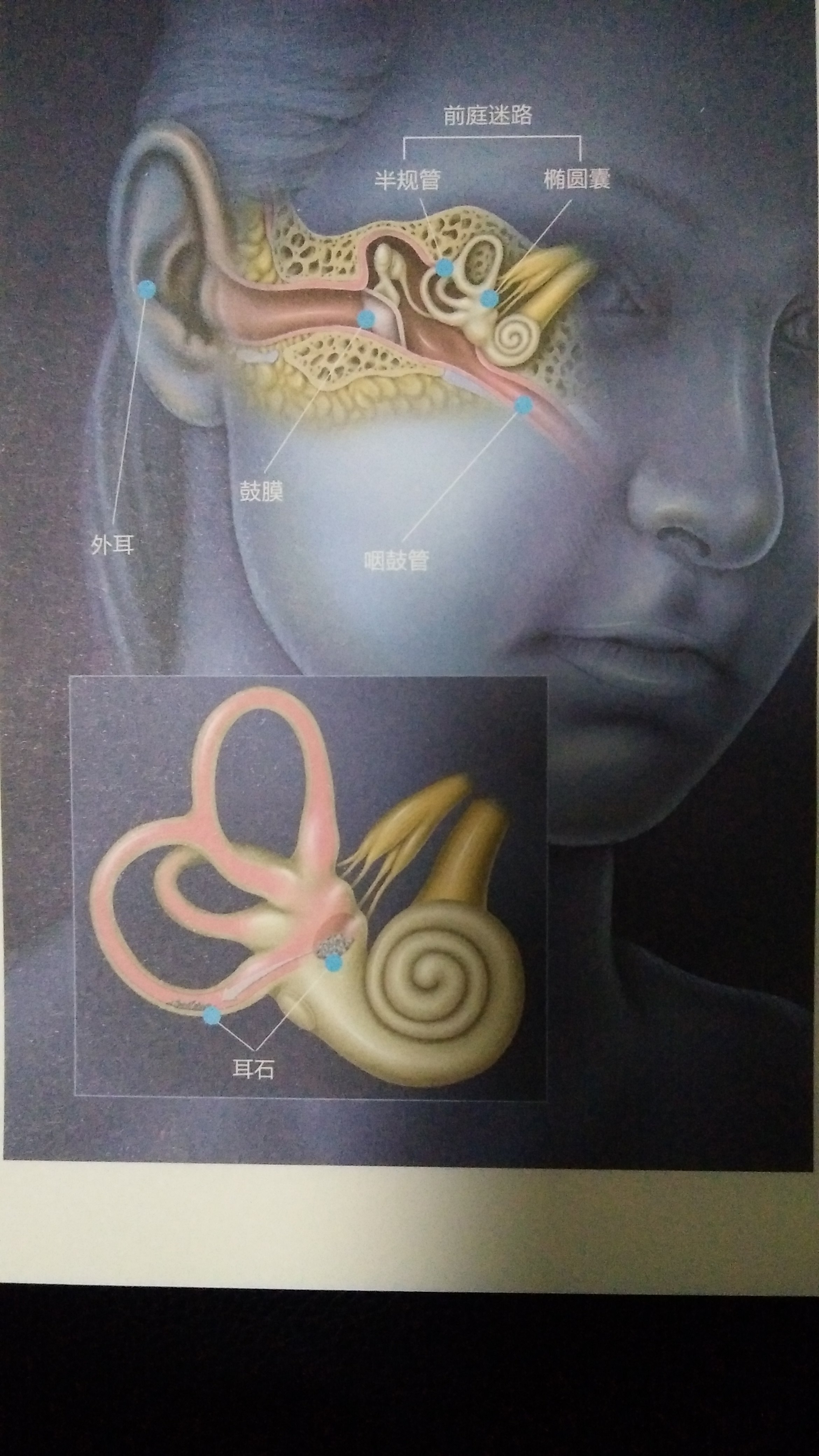 眩晕发作时间短,和头的位置有关,一天可以晕几次,患者常这样描述耳石