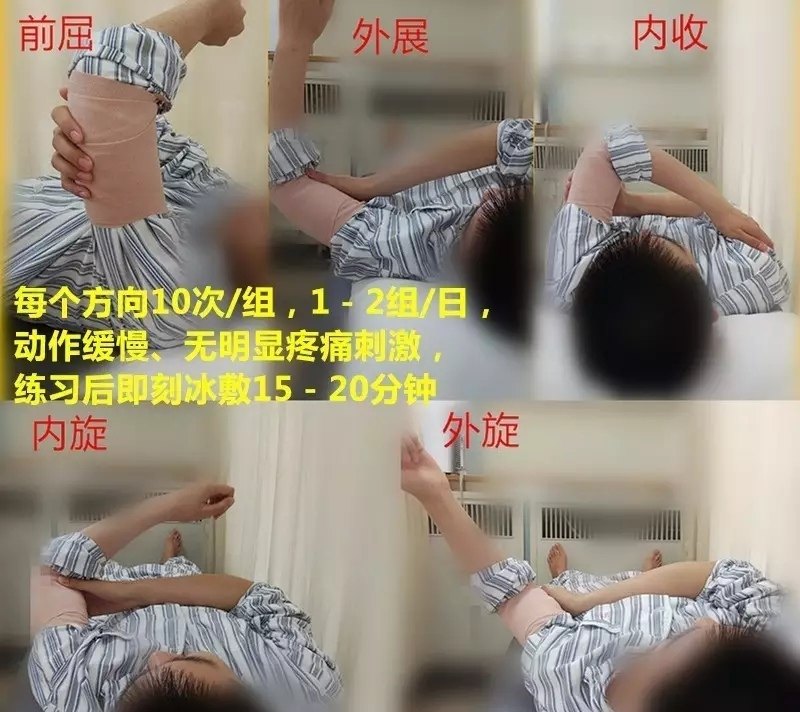 锁骨骨折术后康复
