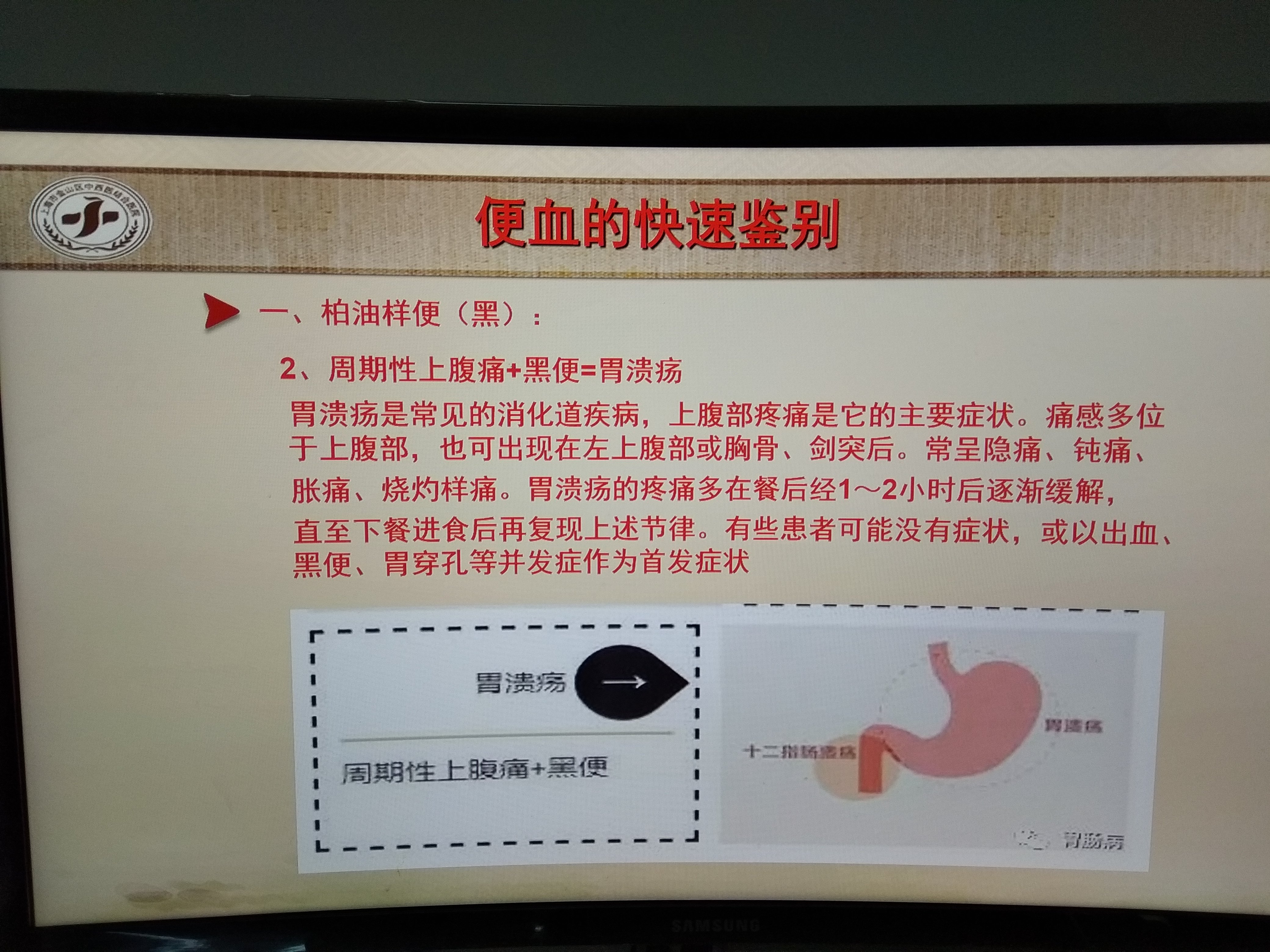 胃溃疡引起的便血特点建议专科就诊及完善肠镜等检查排除其他疾病