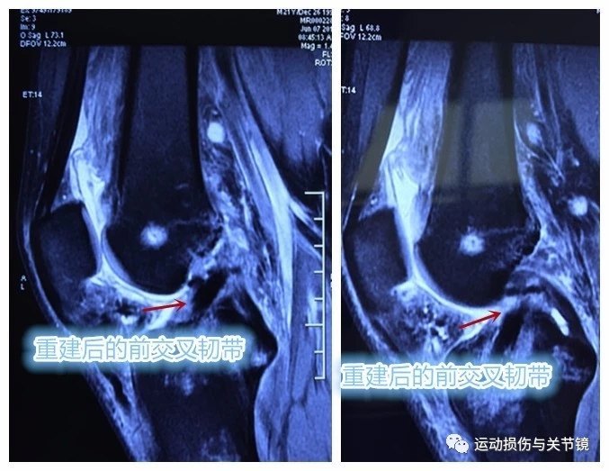 单纯的
