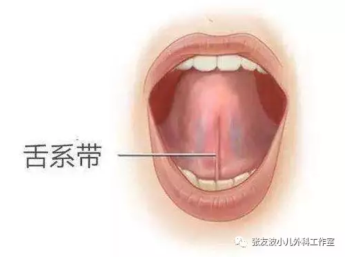 舌系带是指舌下面中线处连于口底的粘膜襞.