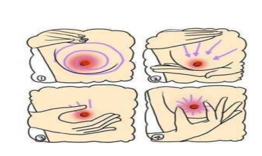 乳腺疾病_乳腺疾病 好大夫在线