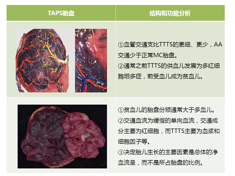 并且脐带插入部位位于胎盘边缘或胎膜上也会增加了siugr的发生风险