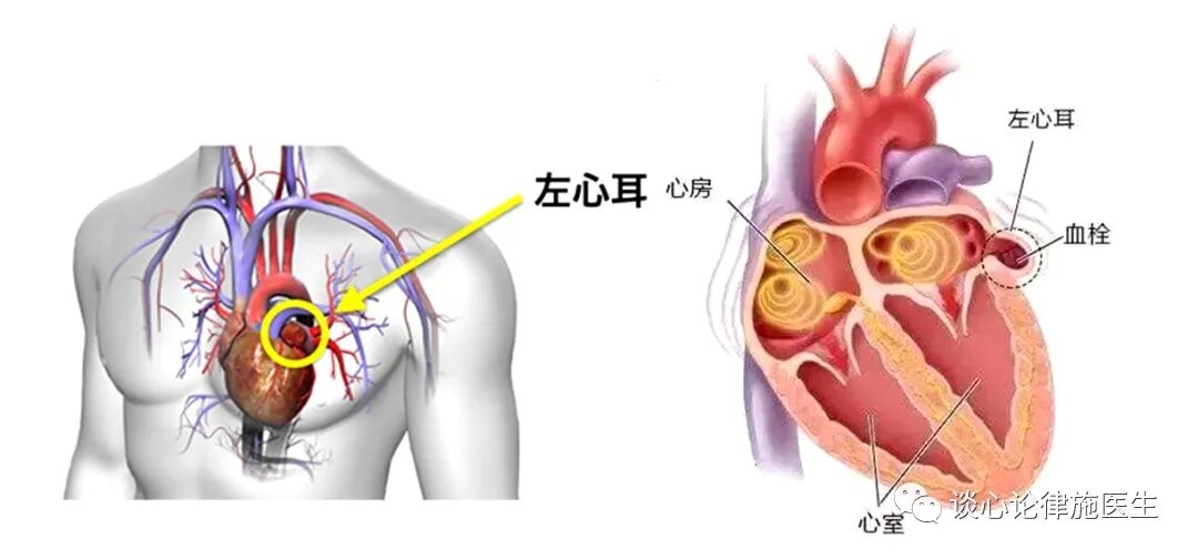 心脏的左右心房分别长了两个独立的结构,外形就像两个耳朵,所以叫做心