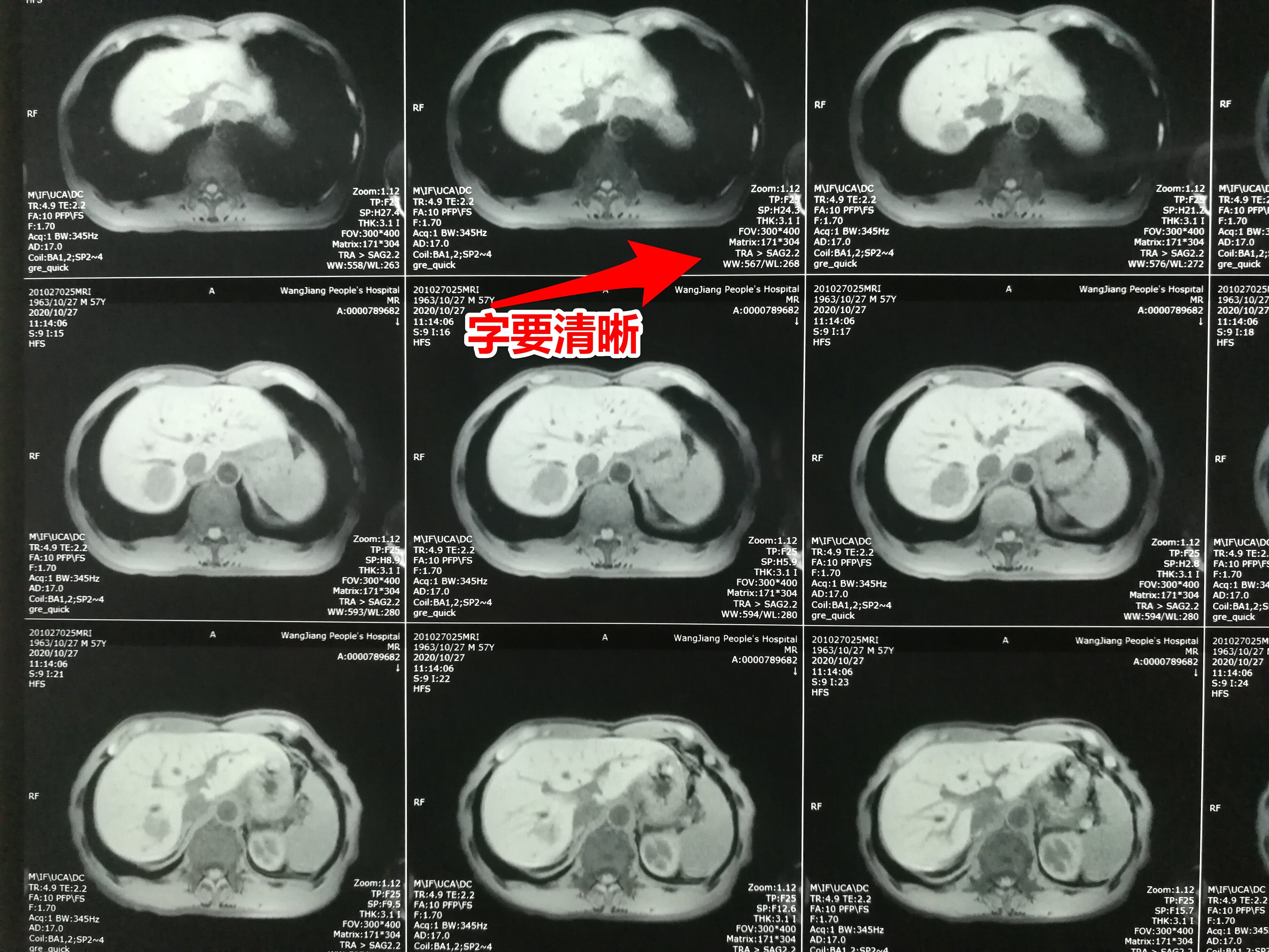 如何拍出适合网络就诊或者会诊的ct,mri照片?