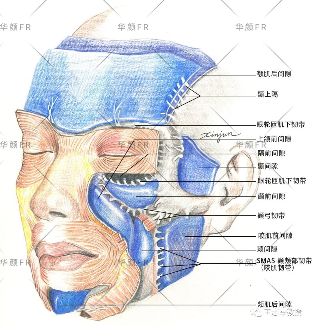 颧突位置的颧弓韧带不离断,其前下方的面中部(俗称苹果肌)的smas和颧