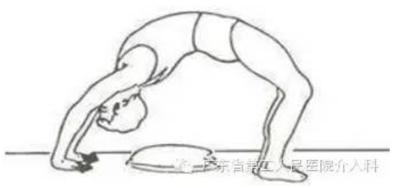 腰椎间盘突出症微创治疗(三)---治疗后的康复锻