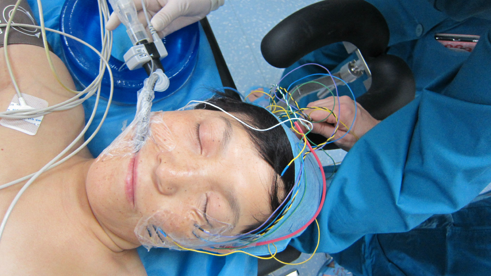 需要神经电生理监测 我们看到患者脸上这几根线链接面肌诱发肌电图的