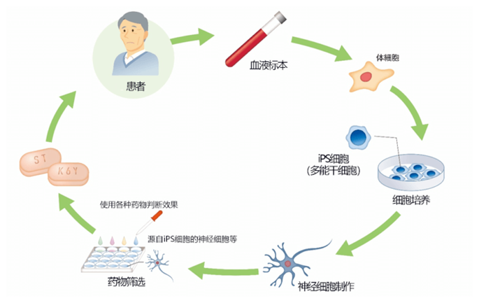 诱导多功能干细胞的方法从患者身上抽取的血液分选出体细胞,通过重