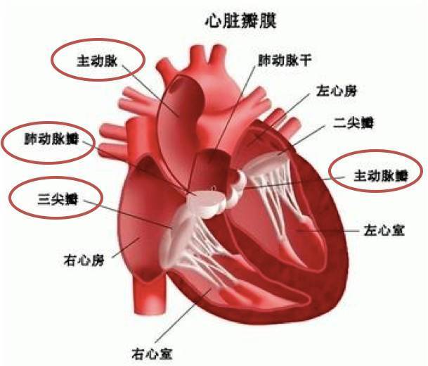 肺动脉瓣三瓣叶解剖图图片