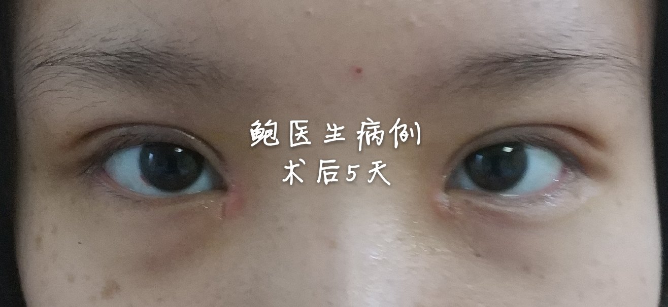 暂无
