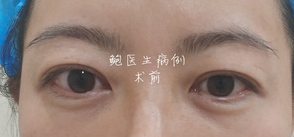 暂无