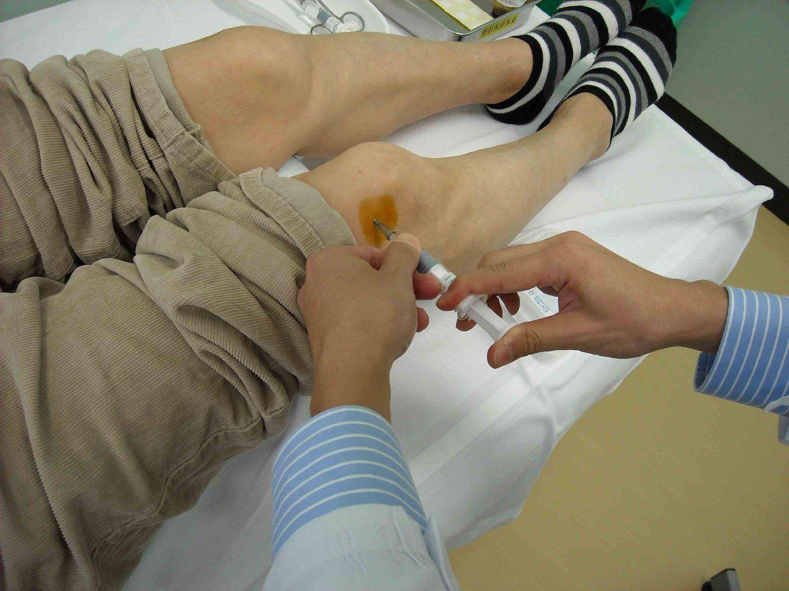 膝关节腔注射 - 好大夫在线