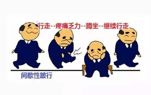 怎样区分神经源性与脊髓源性间歇性跛行 让您瞬间明白