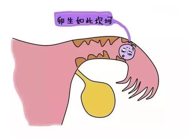 试管婴儿什么时候知道是宫外孕(试管婴儿什么时候知道是宫外孕的)-第2张图片-鲸幼网