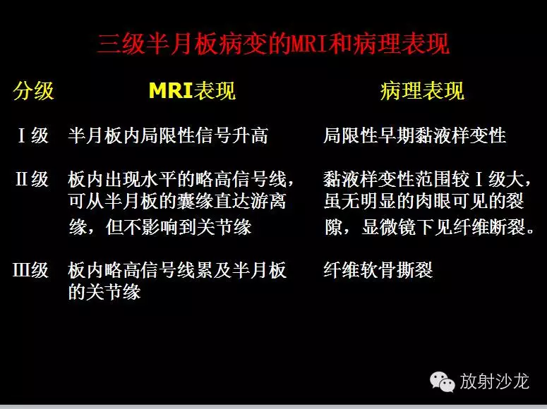 半月板损伤那些事 半月板损伤那些事
