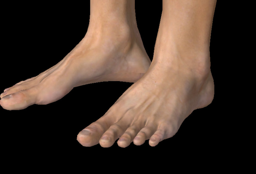 脚后跟痛是怎么回事?