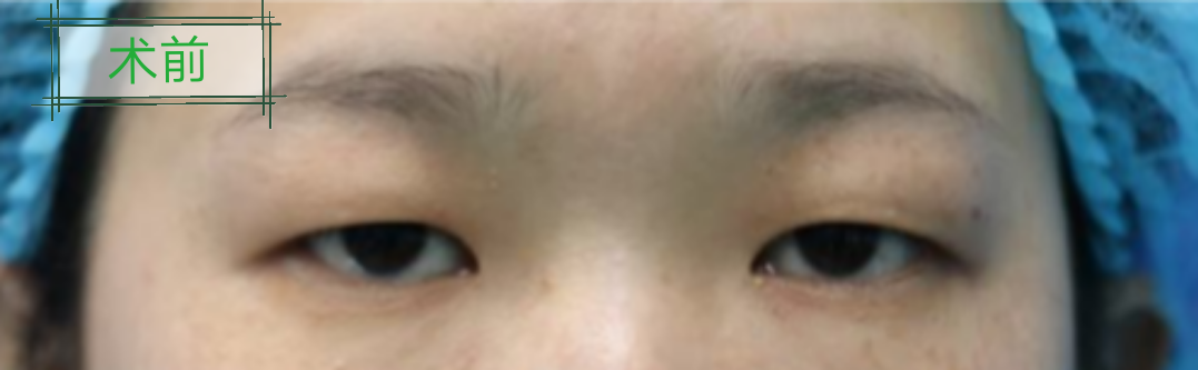 暂无