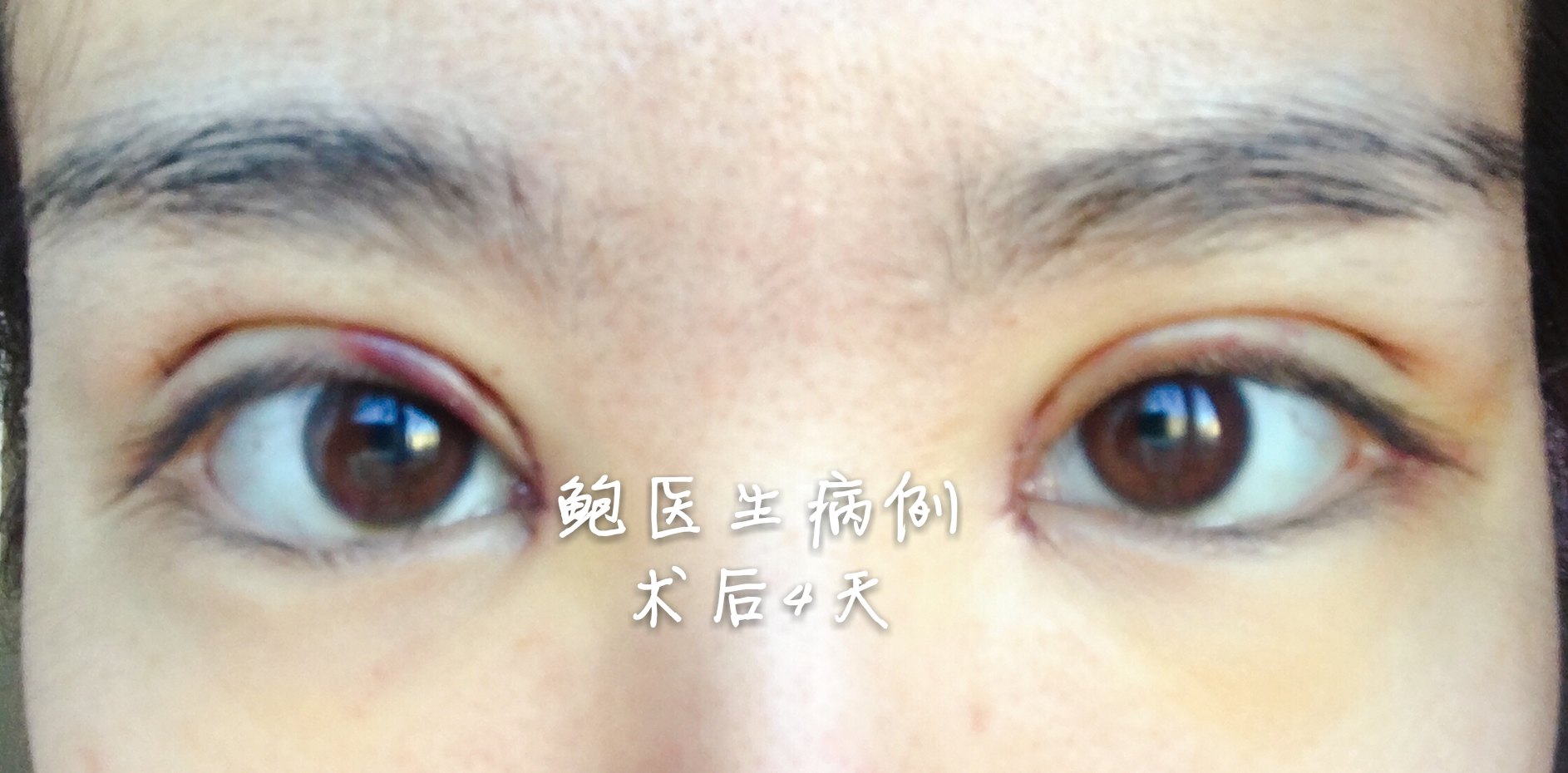 暂无