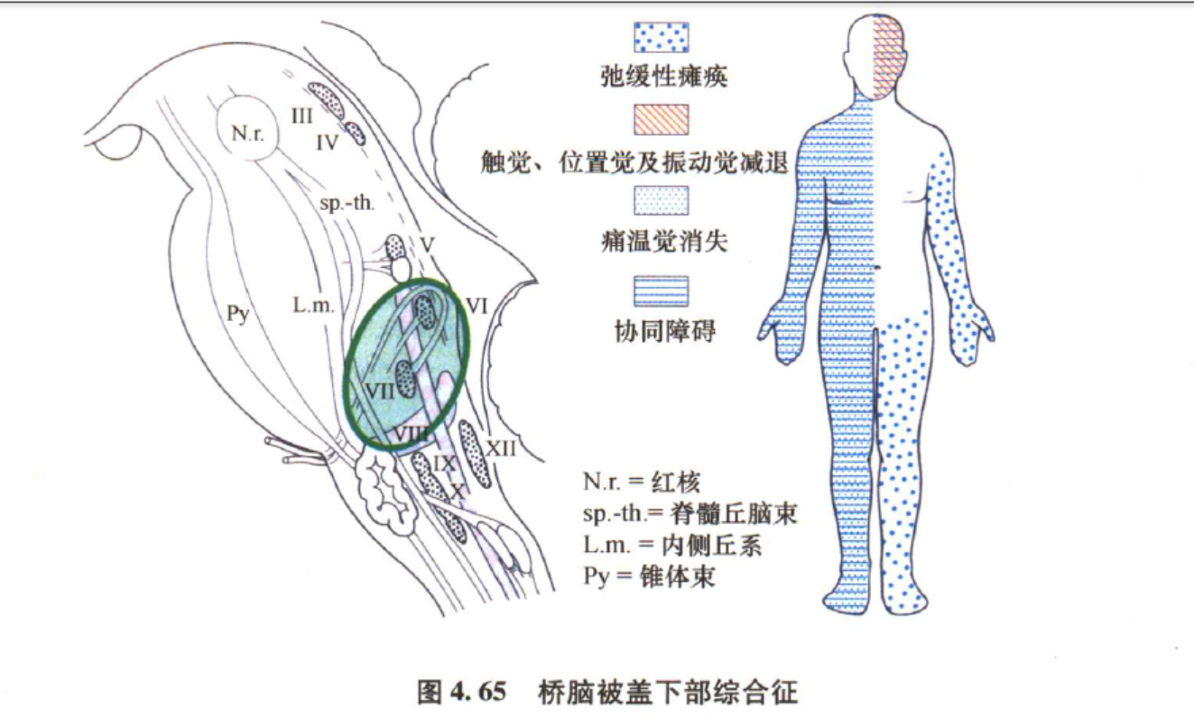 参考《duss神经系统定位诊断学》