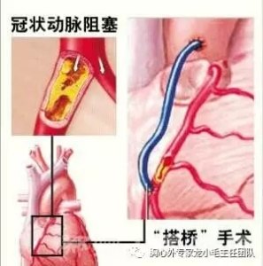 暂无
