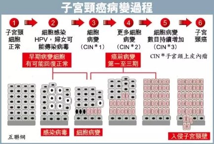 子宫内膜增生 癌变风险有多高 协和妇科医生全部说清楚 患者