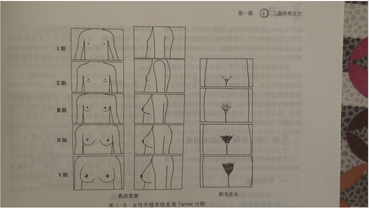 图二临床用于评估青春期性发育的tanner分期图一