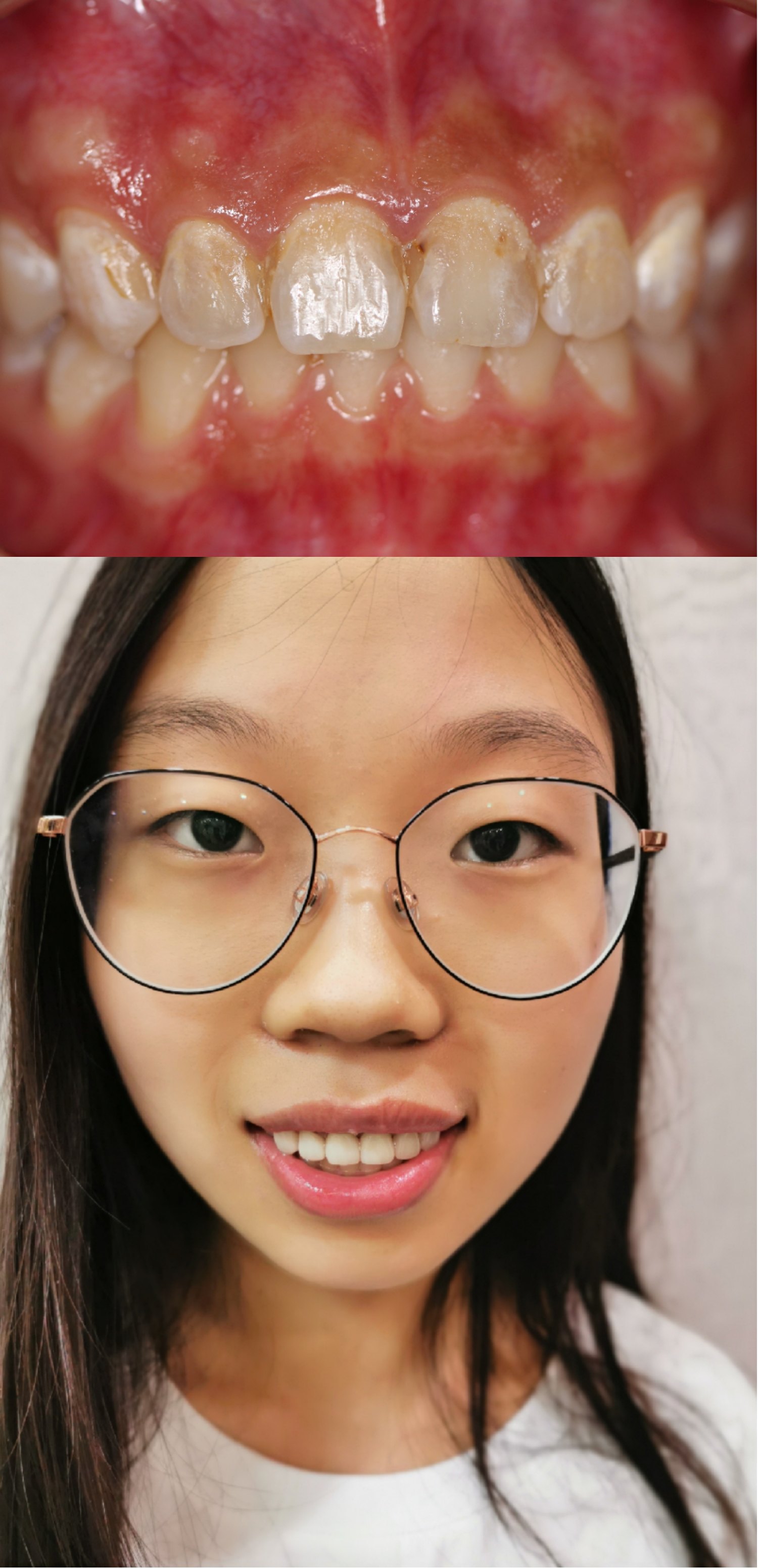 整齐的白牙才美丽 - 好大夫在线