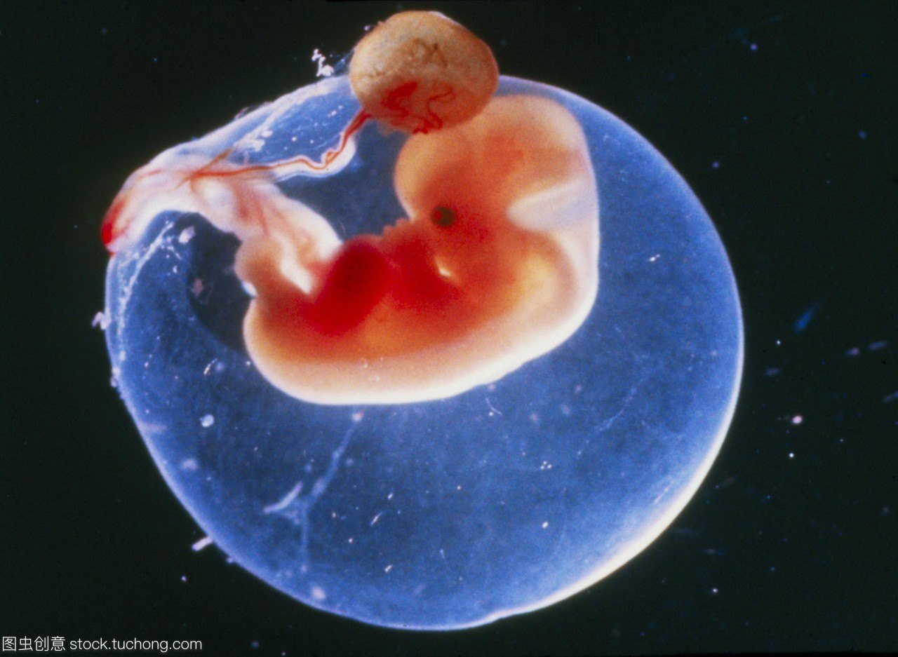 孕早期胚胎图片