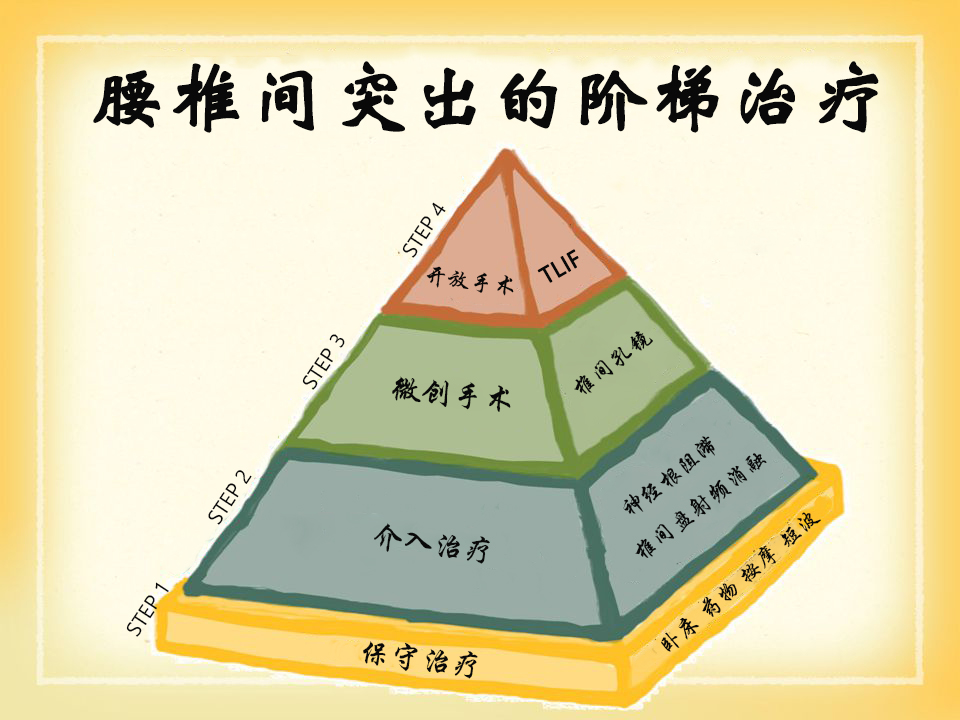 腰椎间盘突出的阶梯治疗——手术并不是首选!