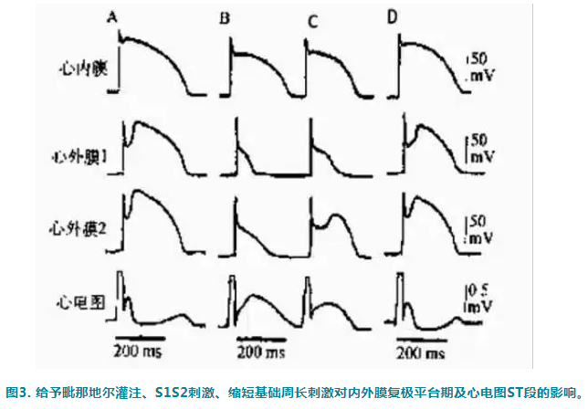 心電圖st段抬高與壓低的機制探討
