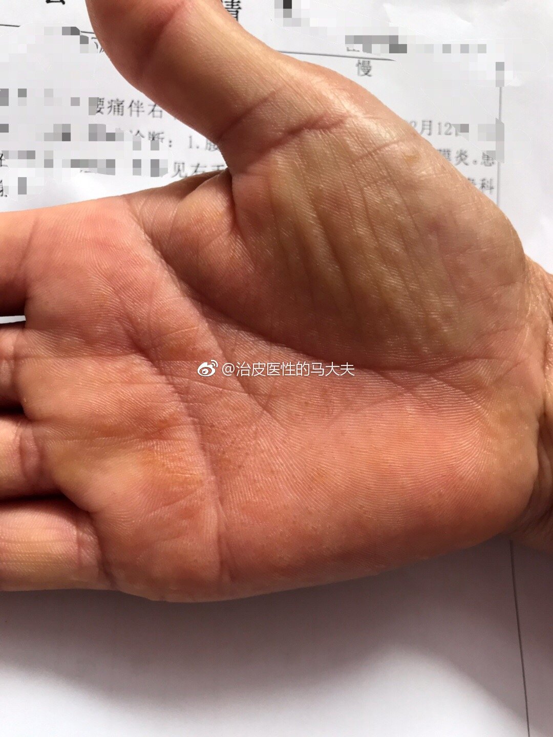 暂无
