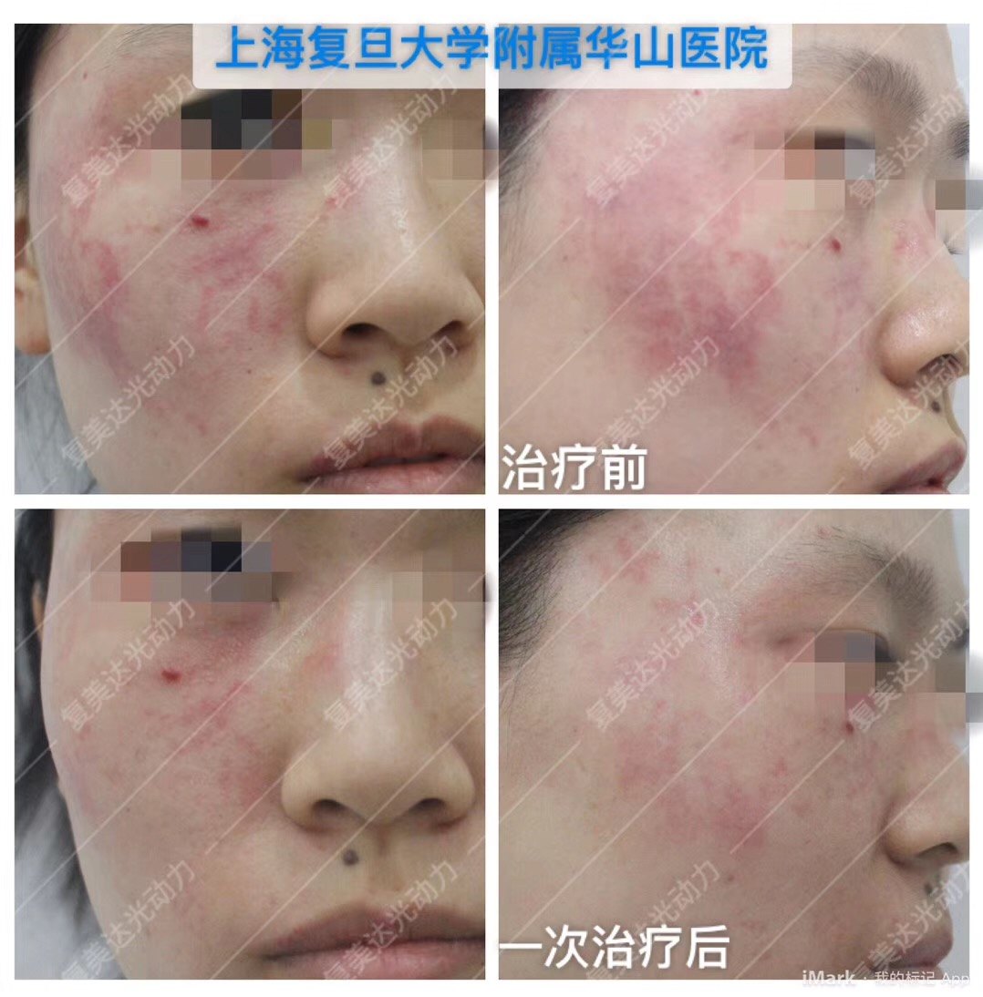 暂无