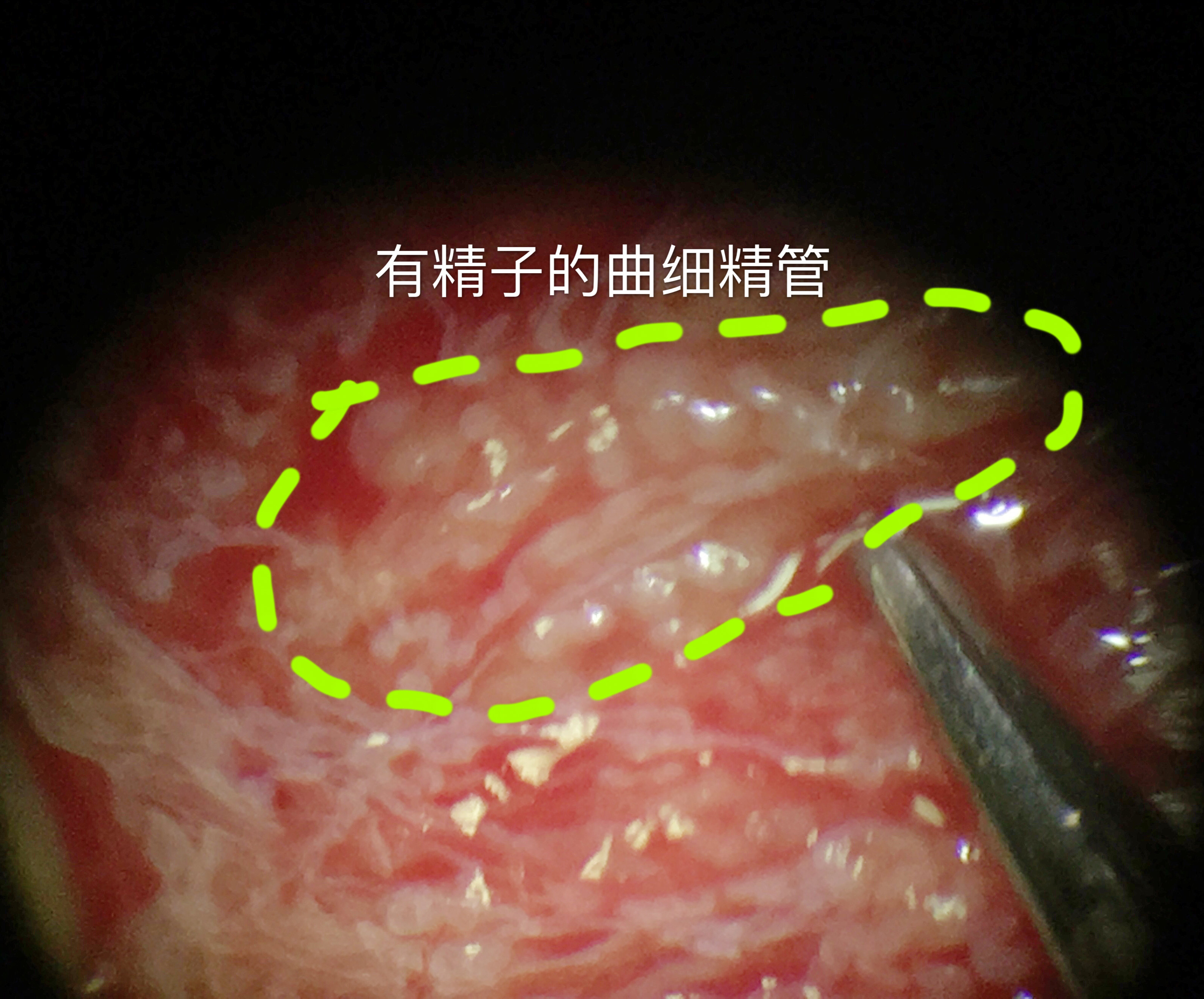 暂无