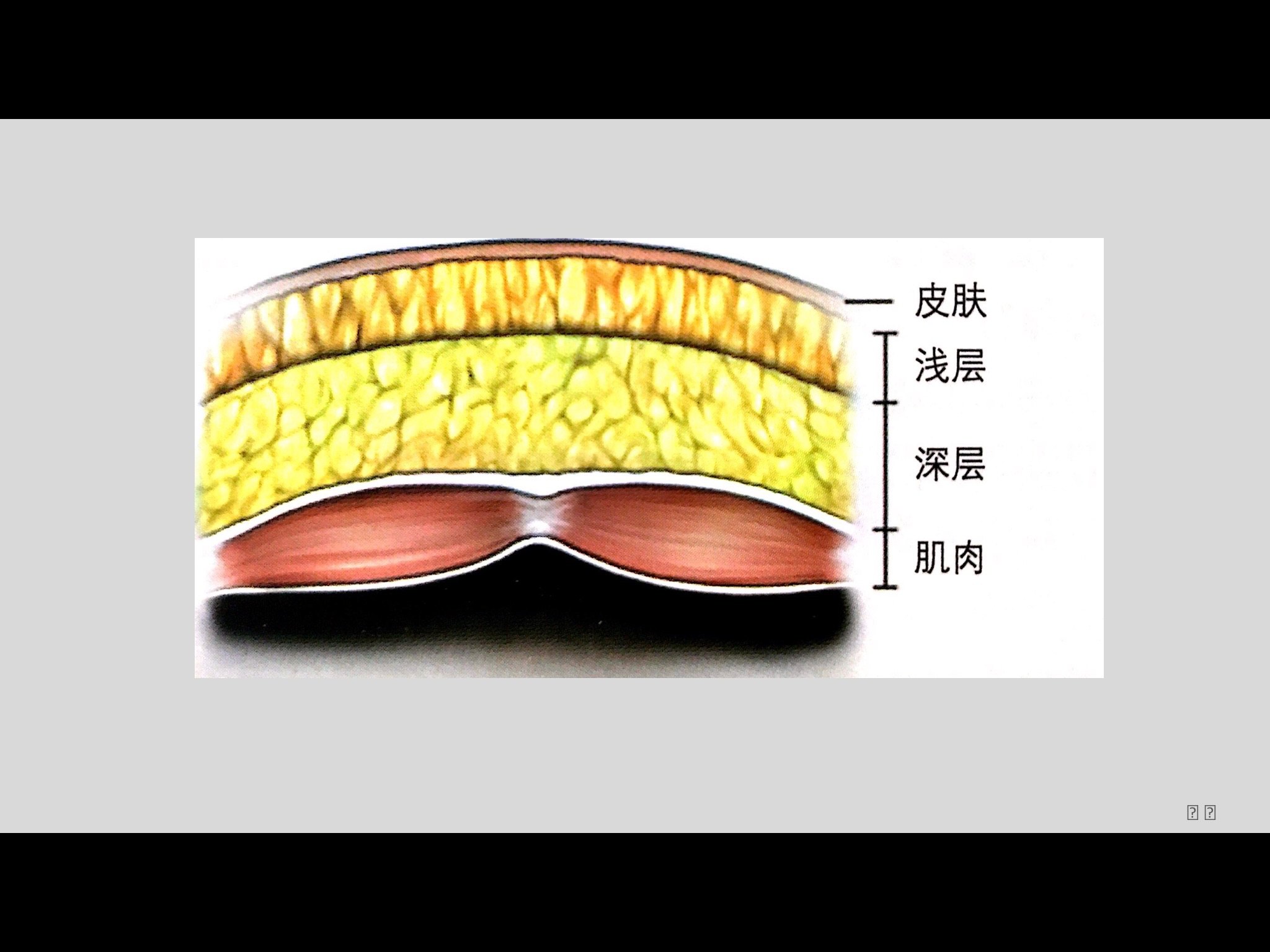 有足夠的體力,要有整形外科精細操作的觀念,要對解剖層次有準確的把握